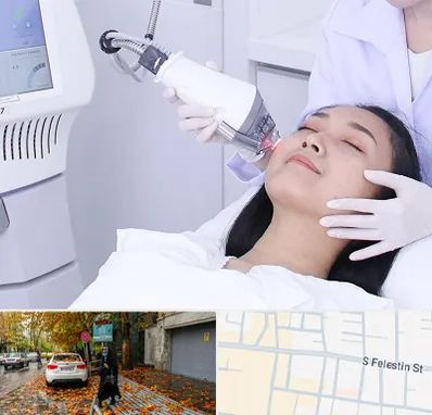 وایتنینگ در خیابان فلسطین