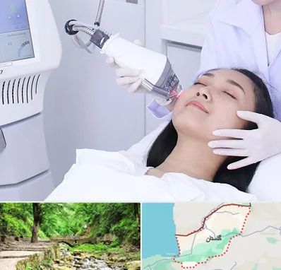 وایتنینگ در گلستان