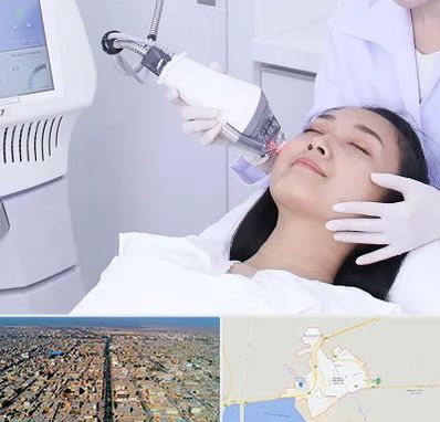 وایتنینگ در بندر ماهشهر