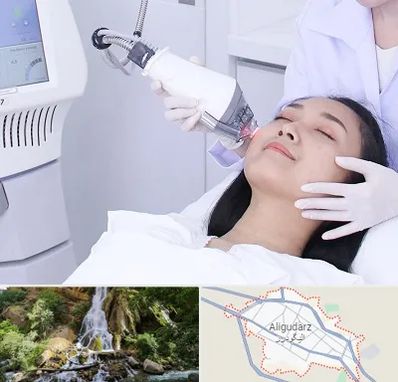 وایتنینگ در الیگودرز