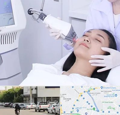 وایتنینگ در قدوسی شرقی شیراز