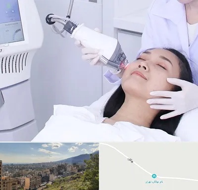 وایتنینگ در بوکان تهران