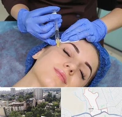 تزریق پروفایلو در اوین