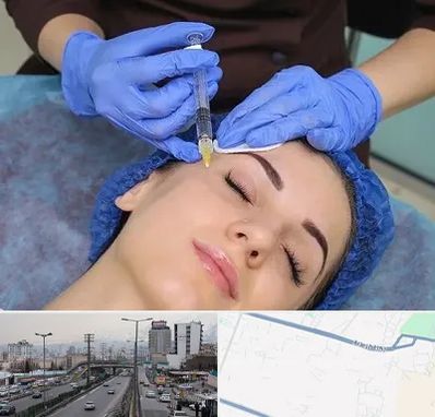 تزریق پروفایلو در بلوار ارتش