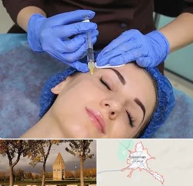 تزریق پروفایلو در تویسرکان