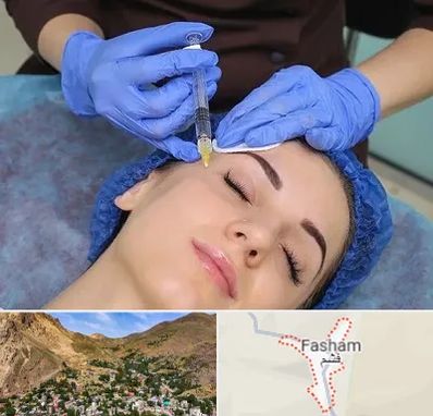 تزریق پروفایلو در فشم