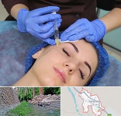تزریق پروفایلو در سراوان