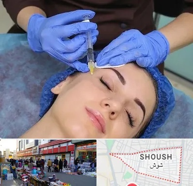 تزریق پروفایلو در شوش