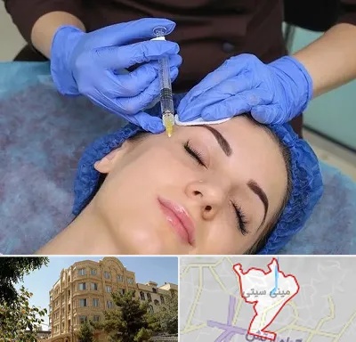 تزریق پروفایلو در مینی سیتی