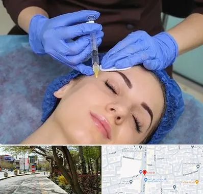 تزریق پروفایلو در خیابان توحید اصفهان