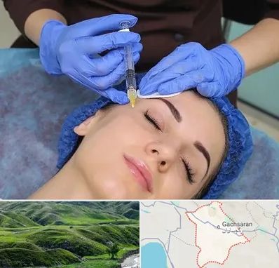 تزریق پروفایلو در گچساران