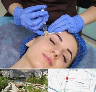 تزریق پروفایلو در بلوار تعاون