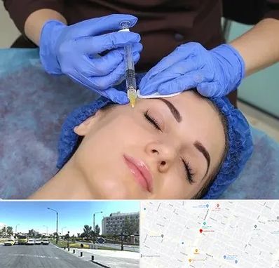 تزریق پروفایلو در بلوار کلاهدوز مشهد