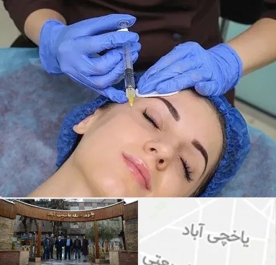 تزریق پروفایلو در یاخچی آباد