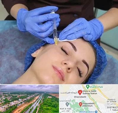 تزریق پروفایلو در قصرالدشت شیراز