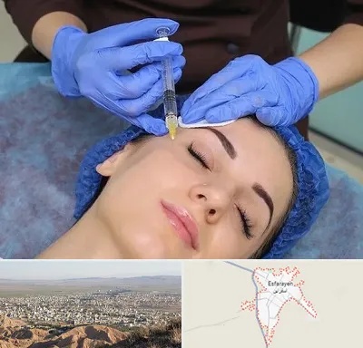 تزریق پروفایلو در اسفراین