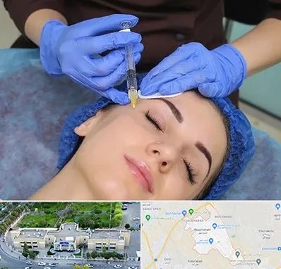 تزریق پروفایلو در نسیم شهر