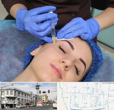 تزریق پروفایلو در 17شهریور