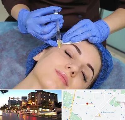 تزریق پروفایلو در بلوار سجاد مشهد