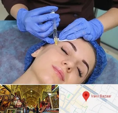 تزریق پروفایلو در بازار وکیل شیراز