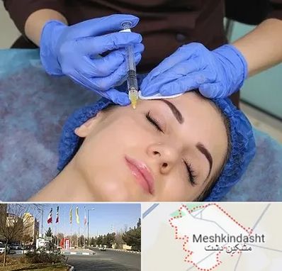 تزریق پروفایلو در مشکین دشت