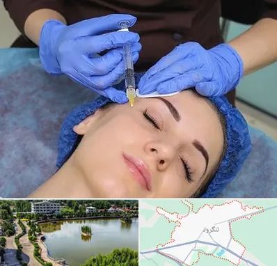 تزریق پروفایلو در لنگرود