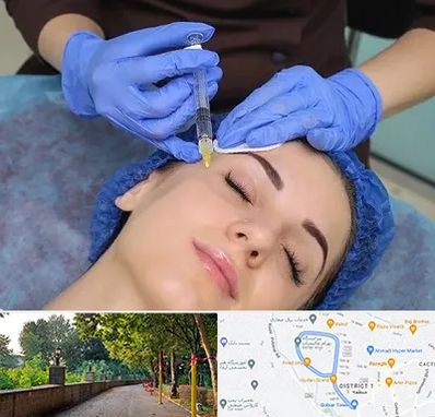 تزریق پروفایلو در بلوار گیلان رشت