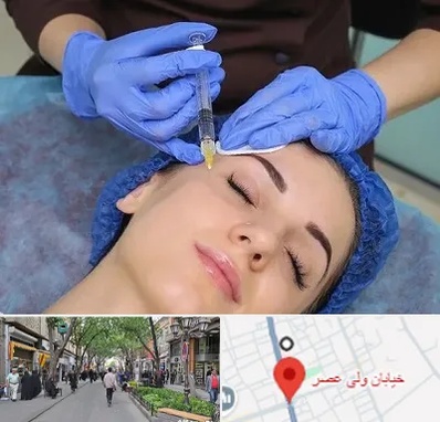 تزریق پروفایلو در ولیعصر شهریار