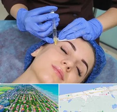 تزریق پروفایلو در فریدونکنار