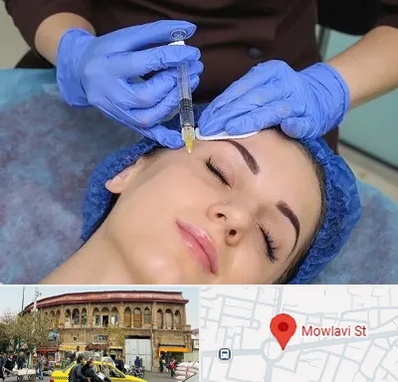 تزریق پروفایلو در مولوی