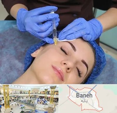 تزریق پروفایلو در بانه