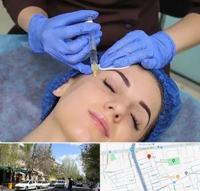 تزریق پروفایلو در کوی فیروز تبریز