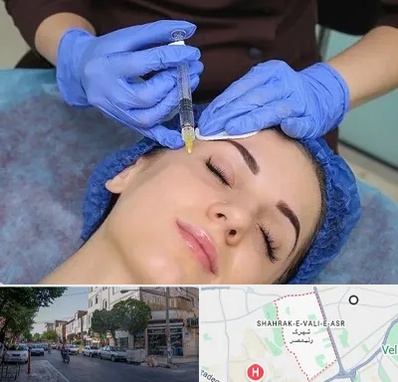 تزریق پروفایلو در شهرک ولیعصر