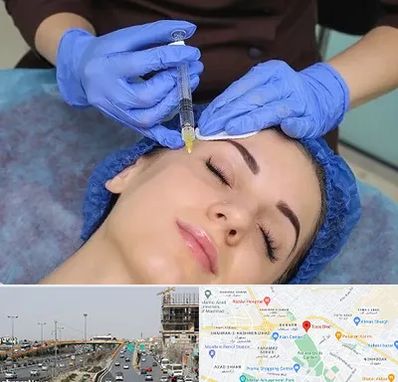 تزریق پروفایلو در بلوار توس مشهد