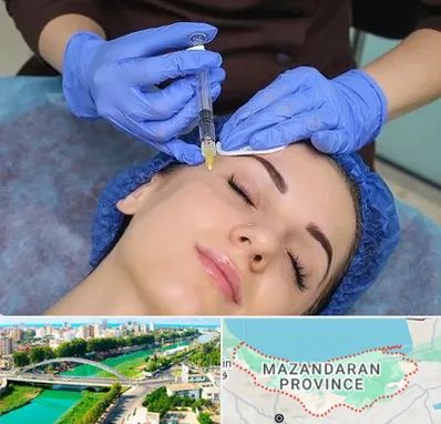 تزریق پروفایلو در مازندران