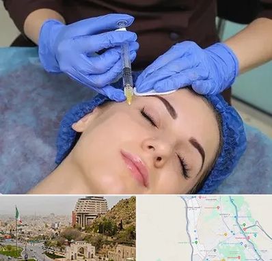 تزریق پروفایلو در فرهنگ شهر شیراز