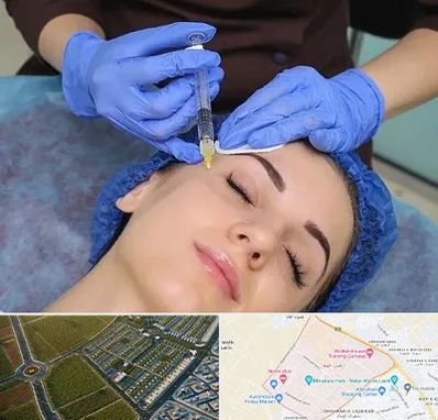 تزریق پروفایلو در الهیه مشهد