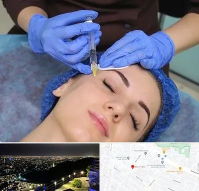 تزریق پروفایلو در هفت تیر مشهد