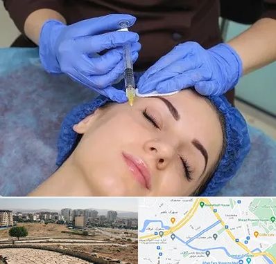 تزریق پروفایلو در کوی وحدت شیراز