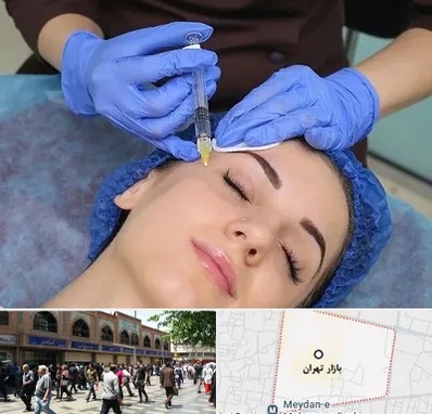 تزریق پروفایلو در بازار تهران