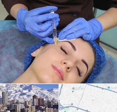 تزریق پروفایلو در ازگل