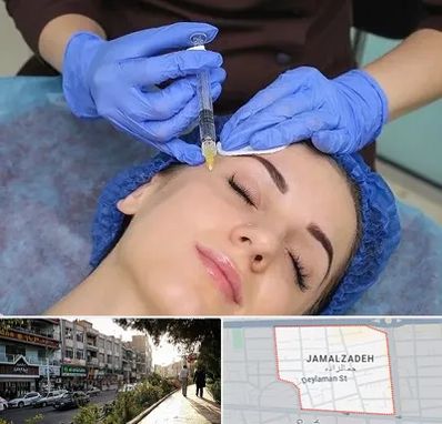 تزریق پروفایلو در خیابان جمالزاده
