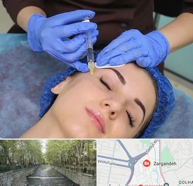 تزریق پروفایلو در زرگنده