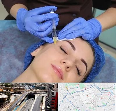 تزریق پروفایلو در ستارخان شیراز