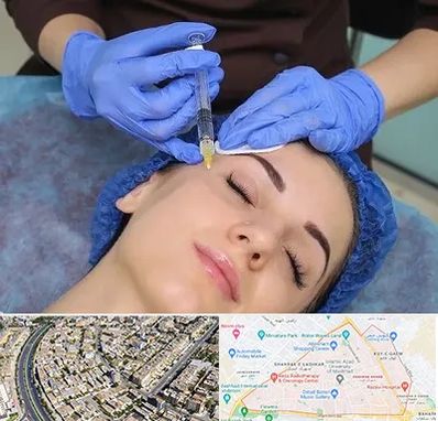 تزریق پروفایلو در شهرک غرب مشهد