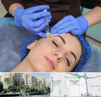 تزریق پروفایلو در آپادانا