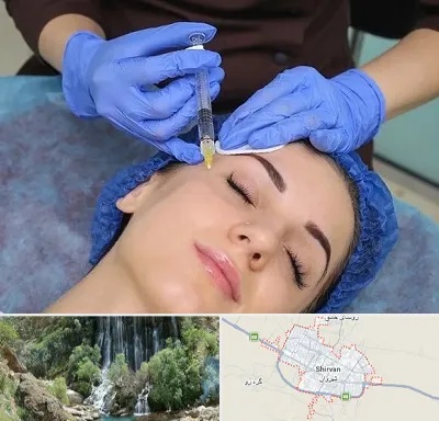 تزریق پروفایلو در شیروان