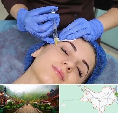 تزریق پروفایلو در فومن