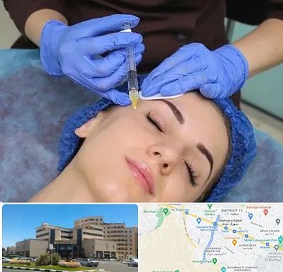 تزریق پروفایلو در صیاد شیرازی مشهد