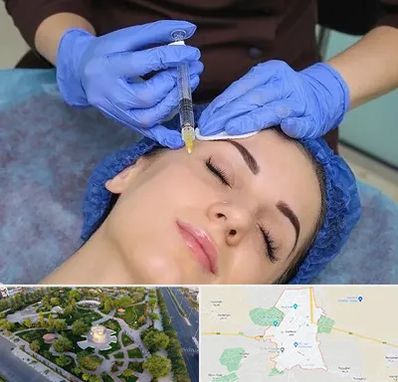 تزریق پروفایلو در کاشمر